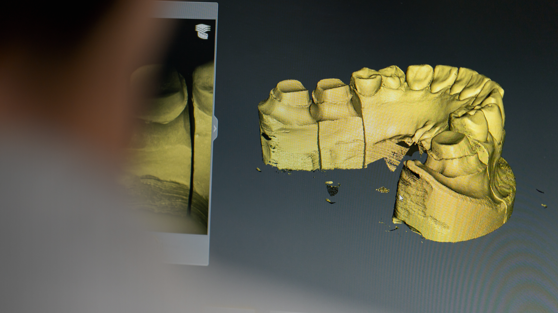 The Role of 3D Scanning and Photography in Digital Smile Design
