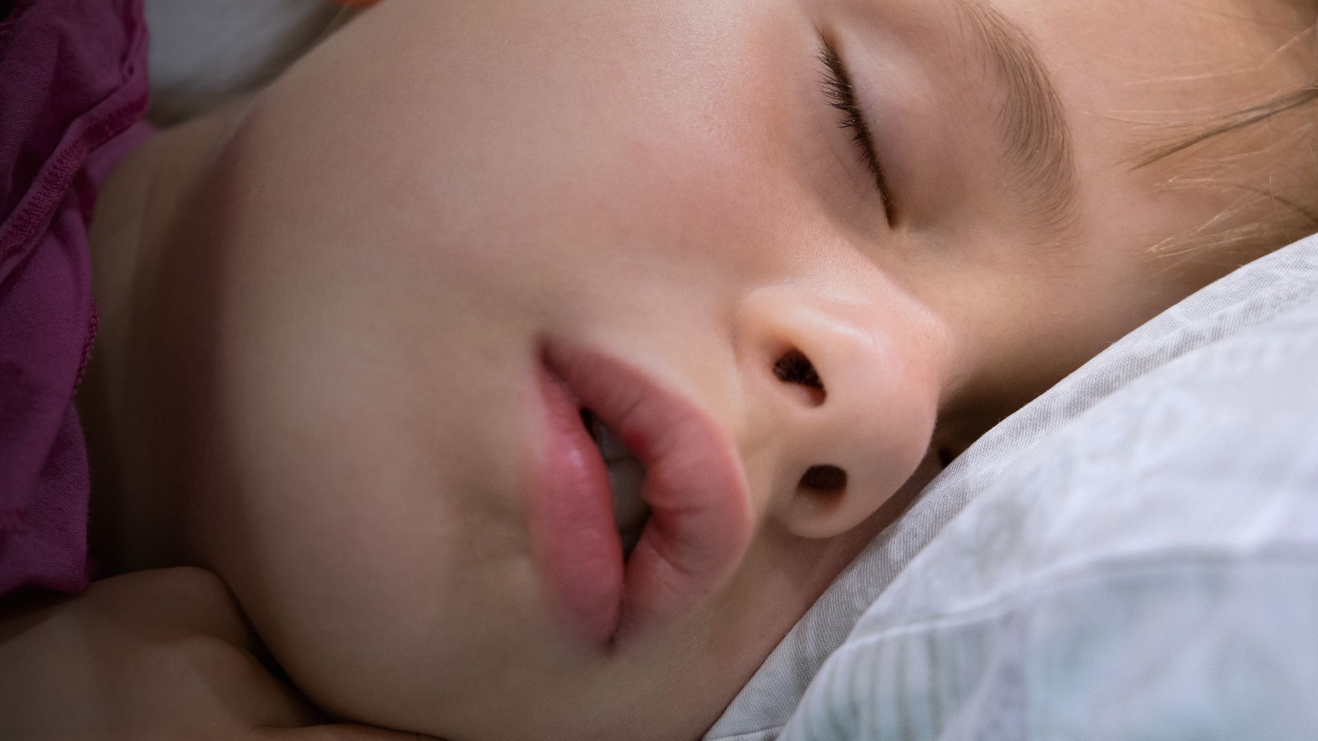 Mouth Breathing, Breath Disorder Sleep( BDS ) and ADHD-Like Symptoms in Children | Vilafortuny