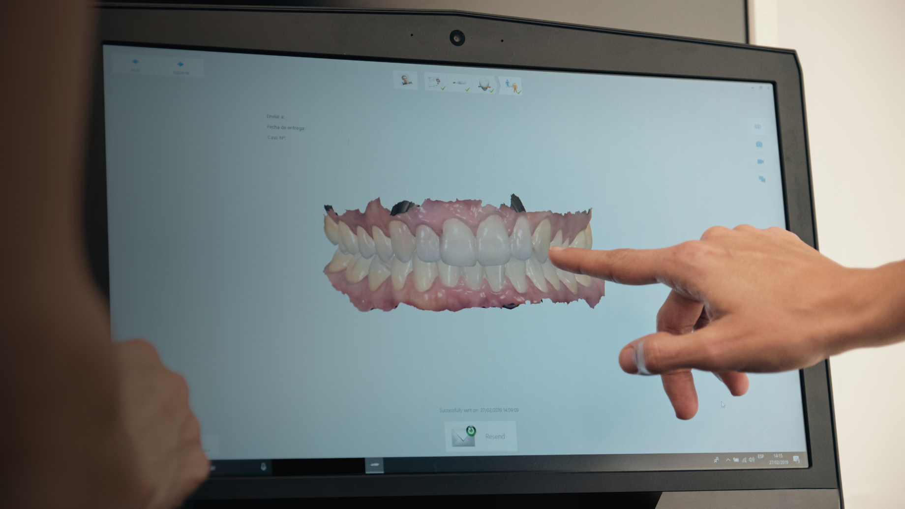 How Digital Smile Design Works: Step by Step to Your Perfect Smile