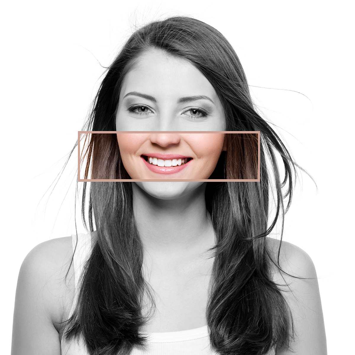 What to Expect from Your DSD Direct Smile Journey