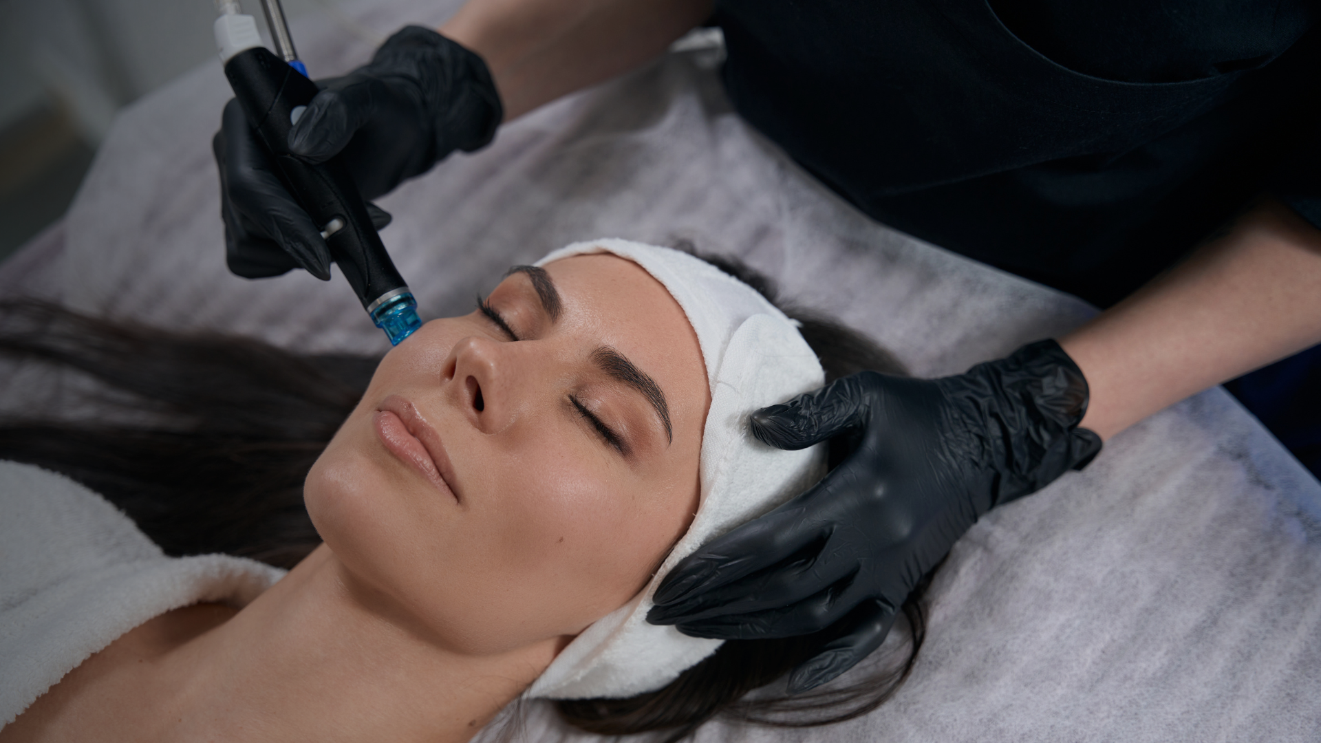 RF Microneedling: A Minimally Invasive Path to Smoother, Younger-Looking Skin