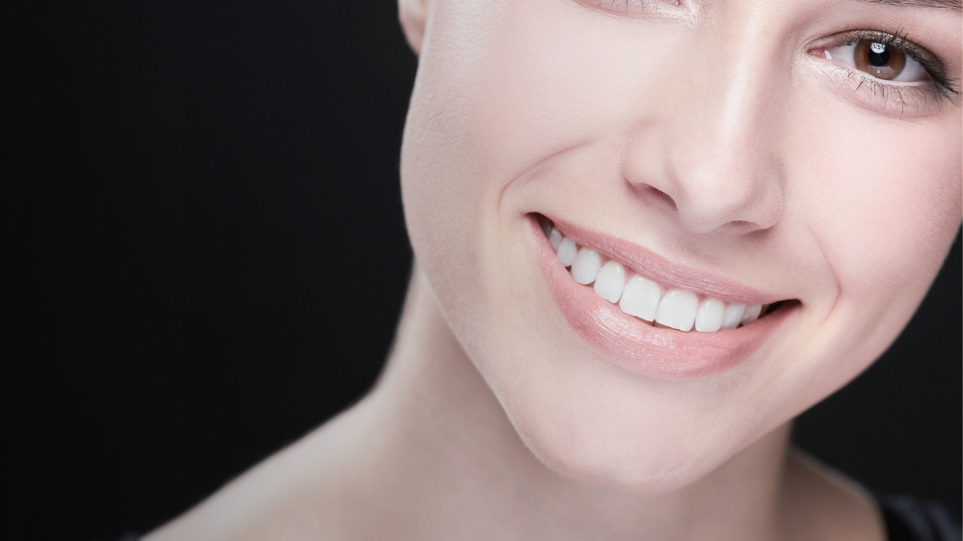 DSD Direct vs Composite Bonding: What Is the Difference?