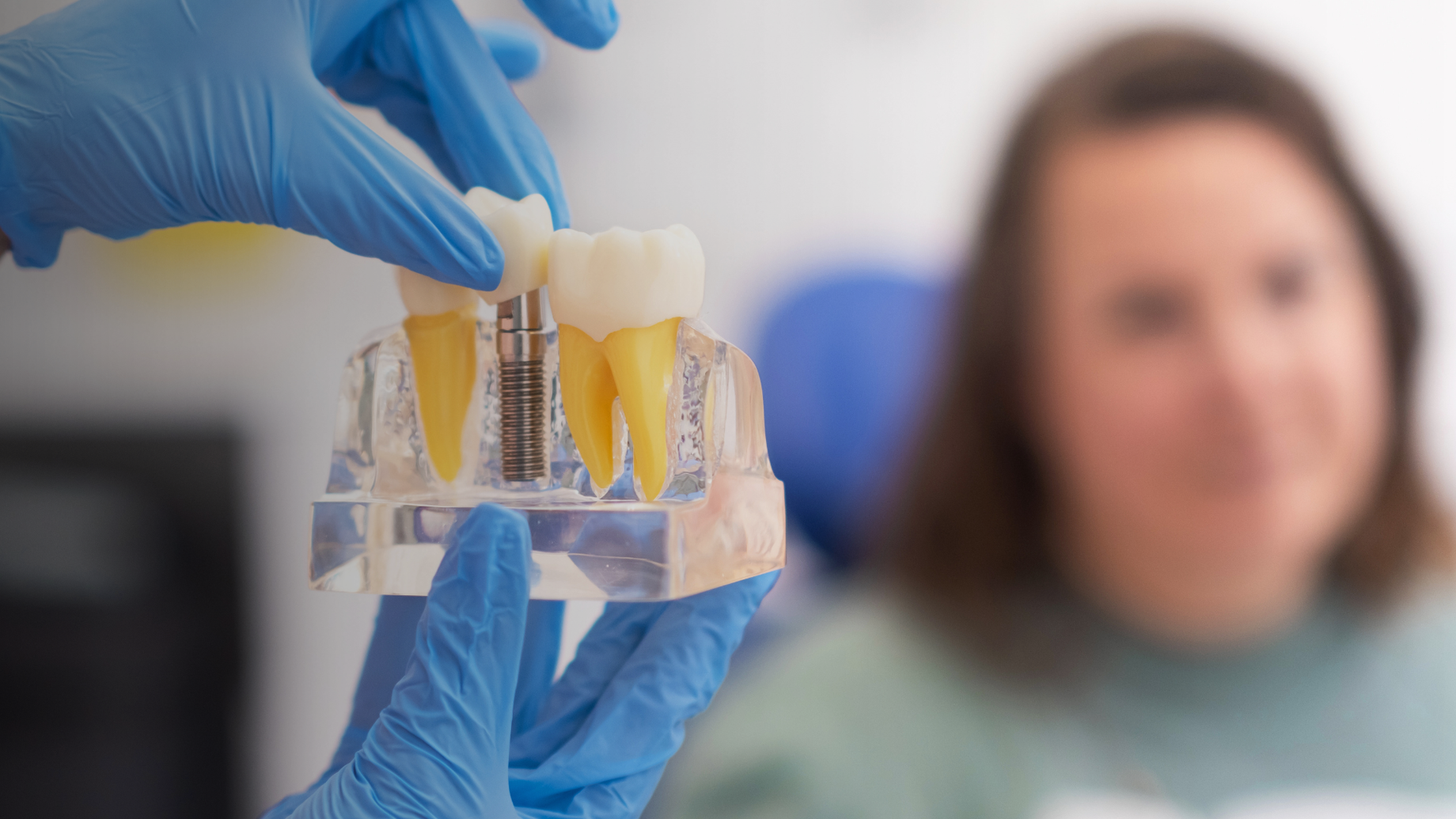 Can Any Dentist Place Dental Implants?