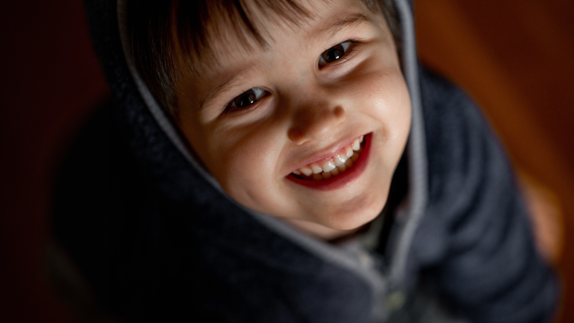 Keeping Your Little One Smiling: General Anaesthesia for Kids