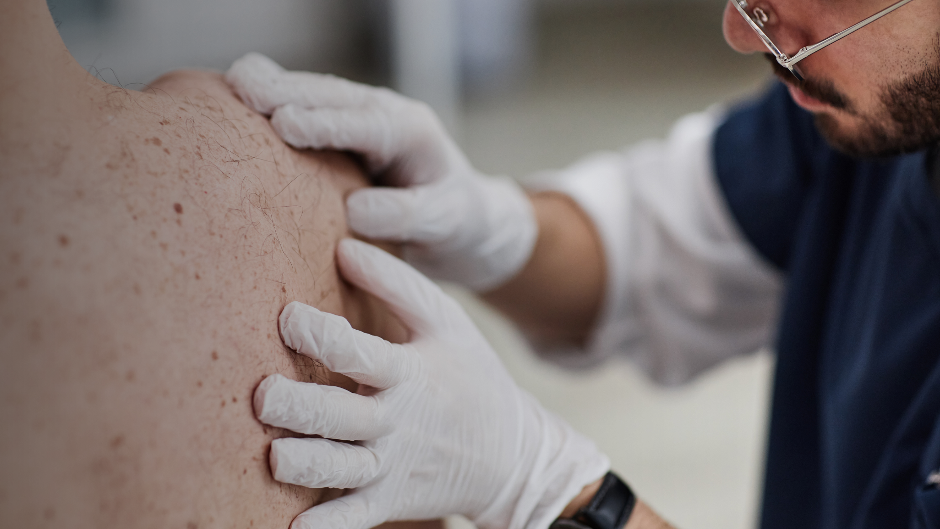 Skin Cancer Screening You Can Trust