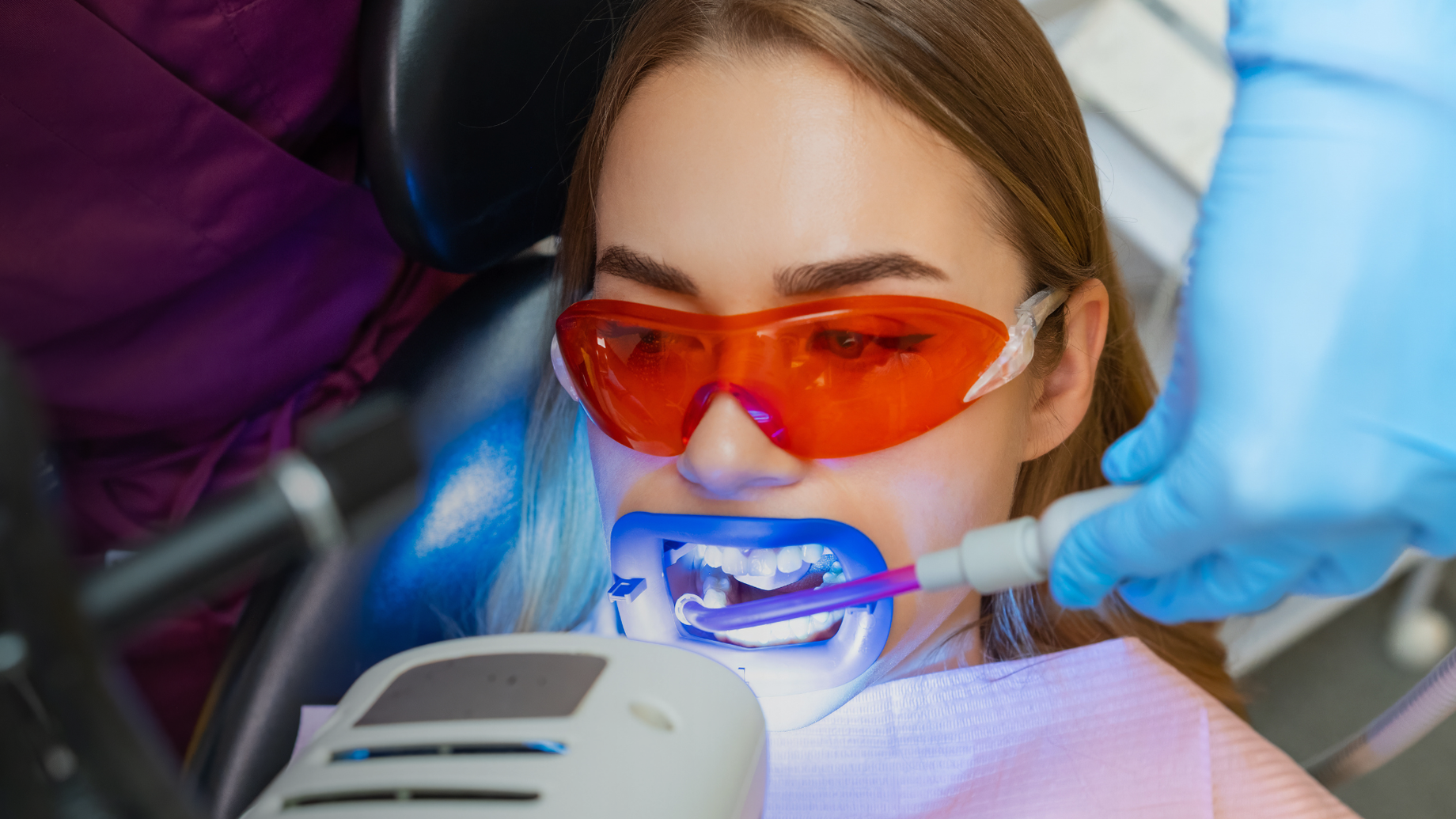 Five Things to Ask Before Teeth Whitening in Dubai